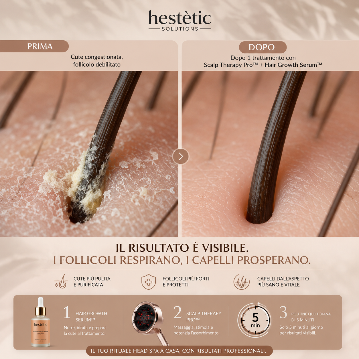 Hestètic Scalp Therapy Pro™ Bestseller 2026
